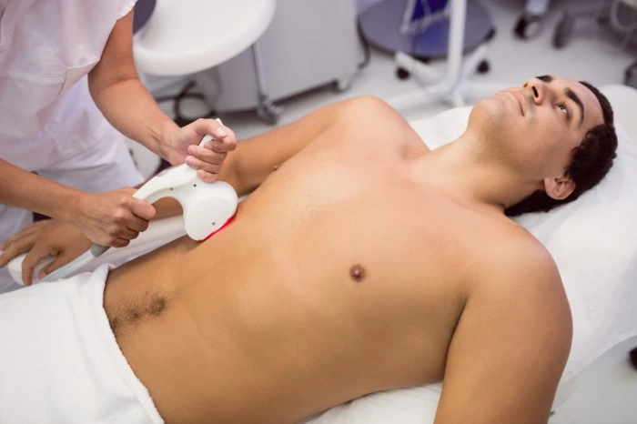 Laser hair removal for men